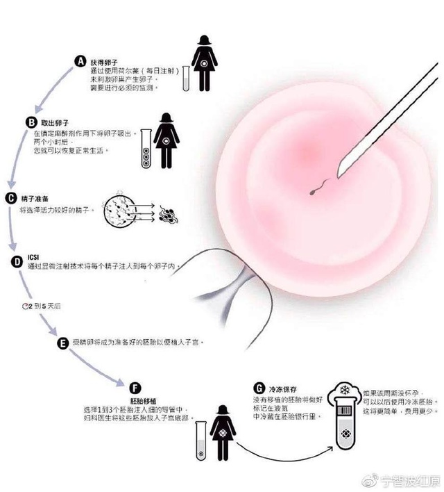 抚州供卵代怀